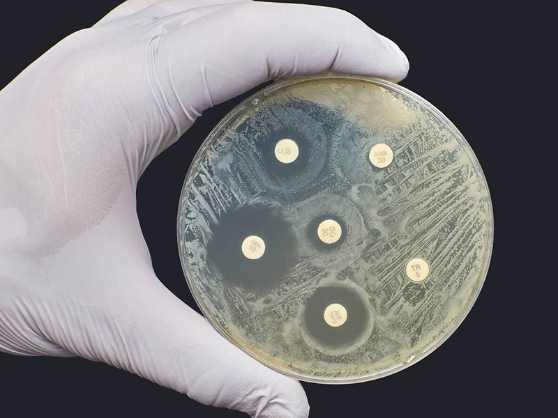 Η σημασία του αντιβιογράμματος